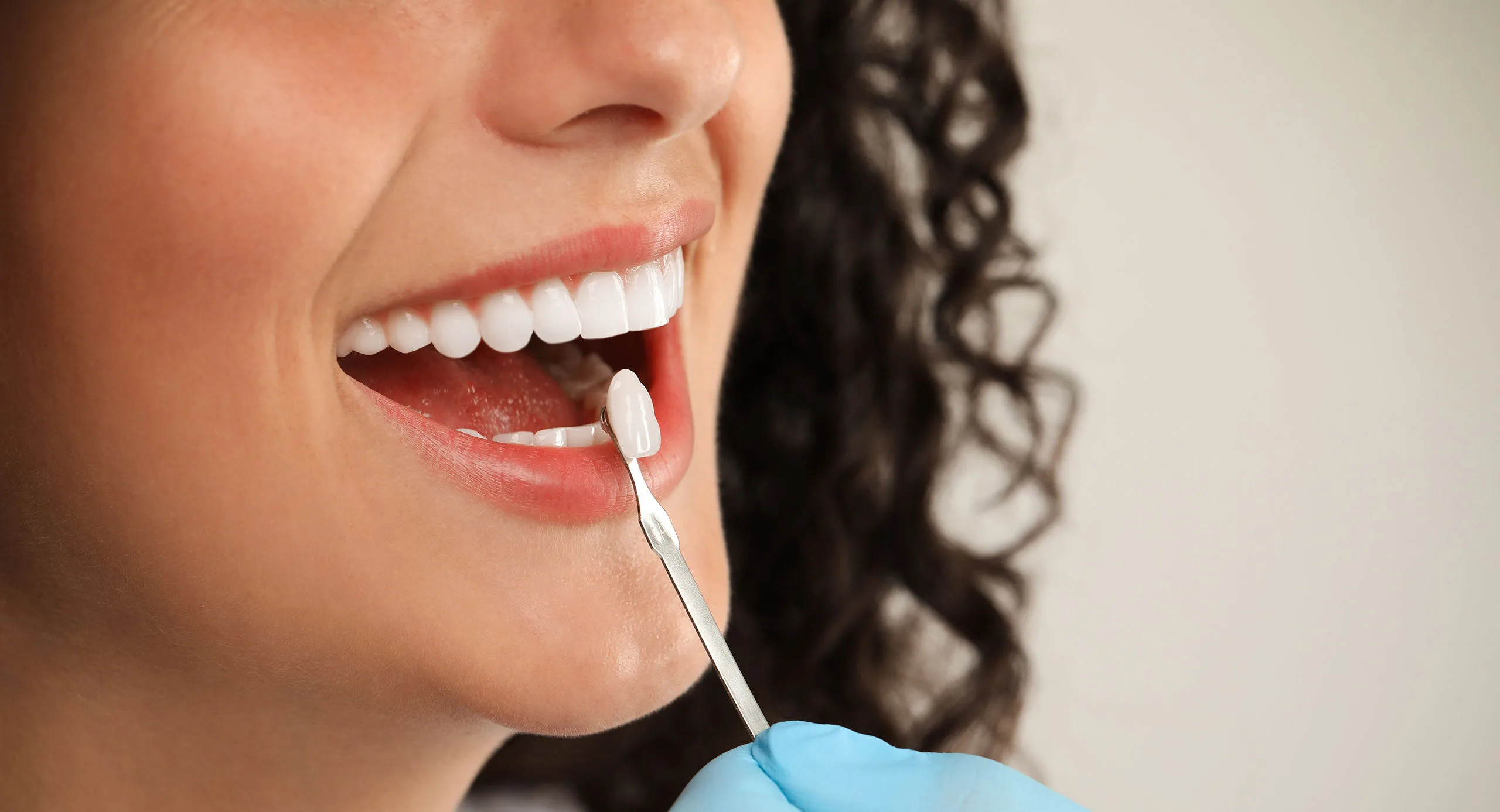 Dental Veneers Close-up of a smiling woman receiving a dental veneer. A gloved hand holds a dental tool applying the veneer to one of her upper front teeth. The woman has white, even teeth and curly dark hair, and the background is softly blurred.