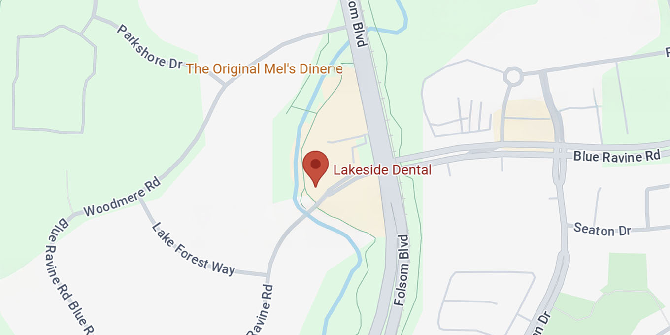 Overhead Map of Lakeside Dental