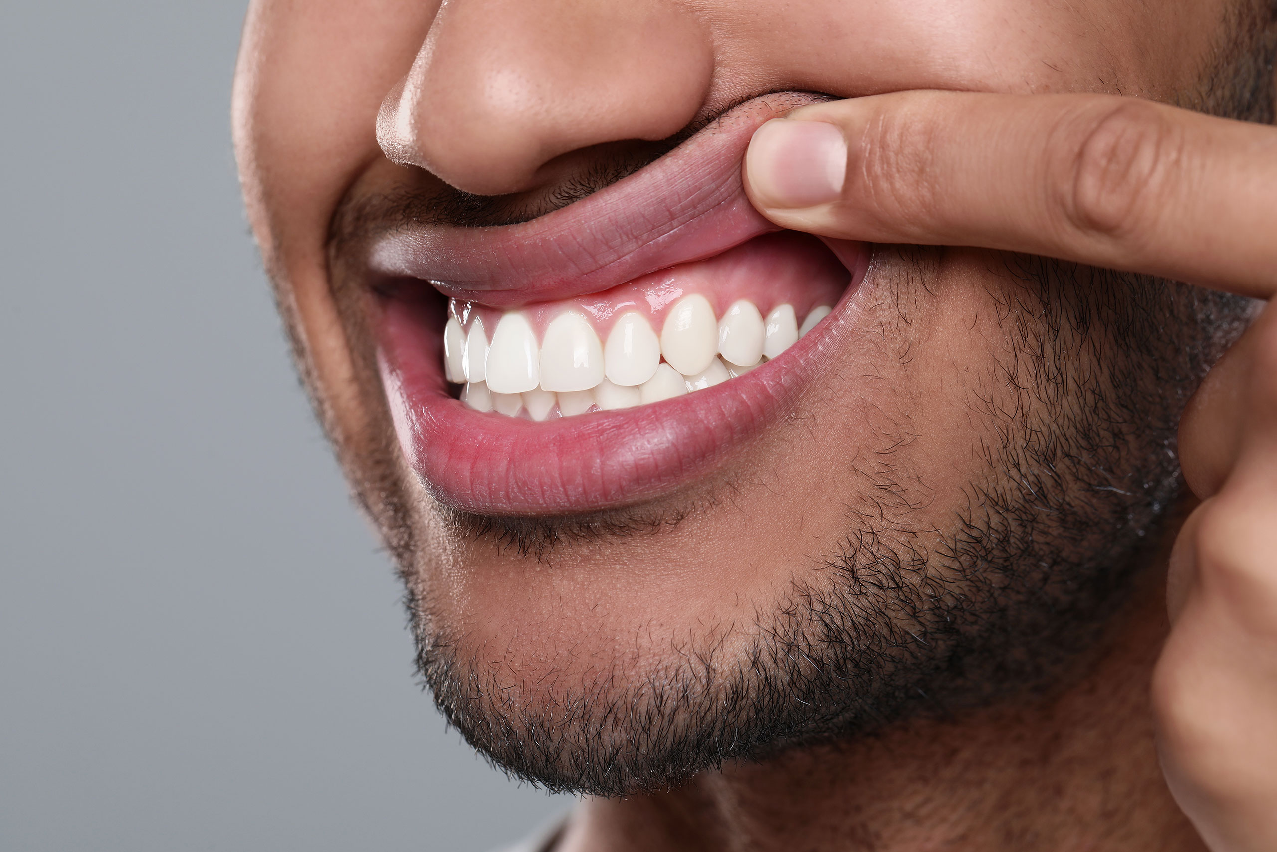 Close-up of a smiling man pulling up his upper lip with his finger to reveal clean, white teeth and healthy pink gums. The man has short facial hair and medium brown skin, with a neutral gray background.