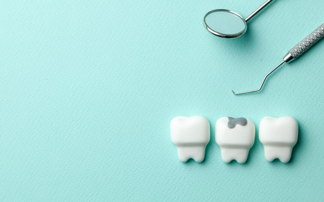 Let’s Talk About Fillings