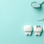 Let’s Talk About Fillings