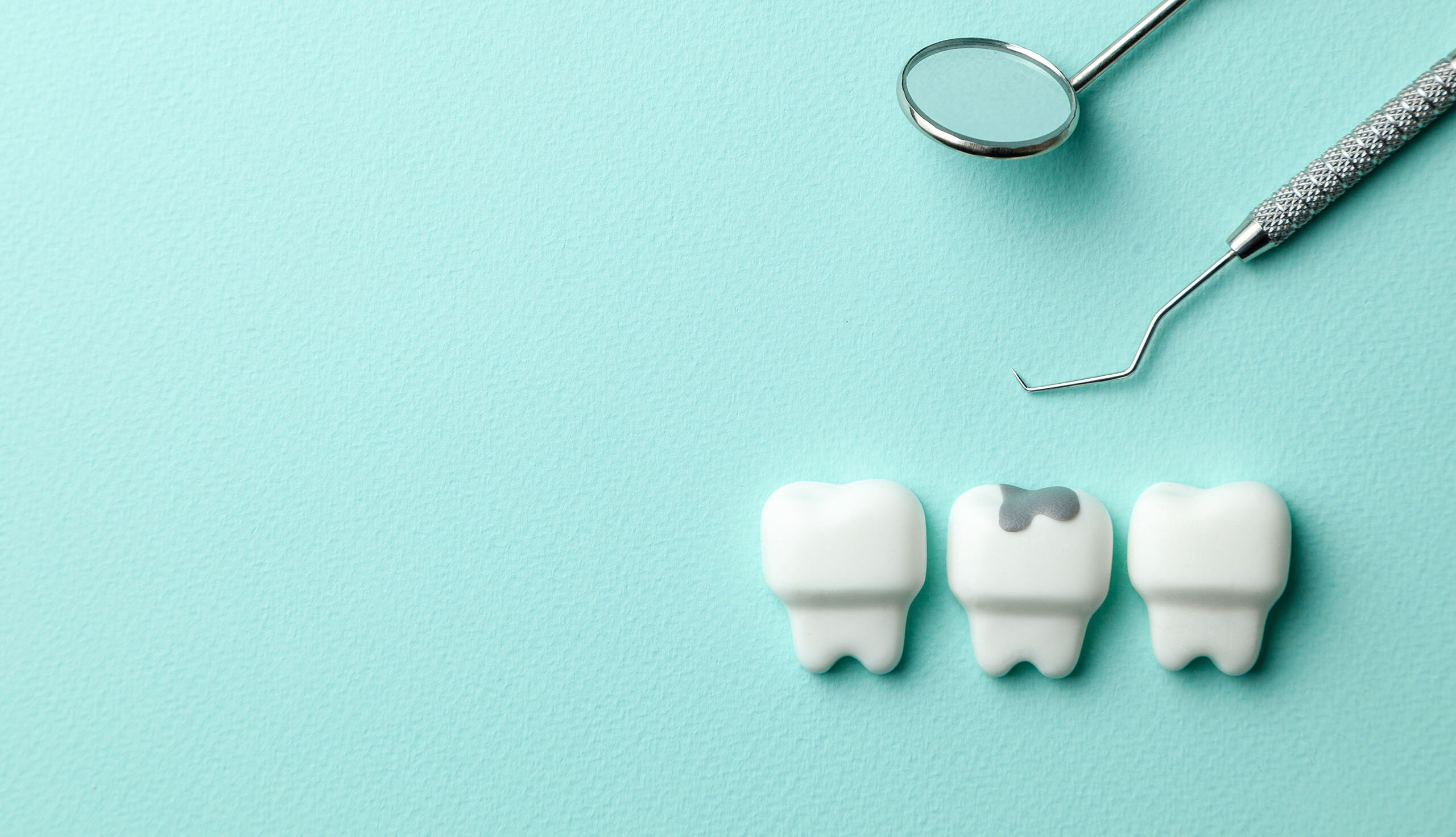 Three tooth models, one showing a gray dental filling, placed beside a dental mirror and explorer on a light blue background.