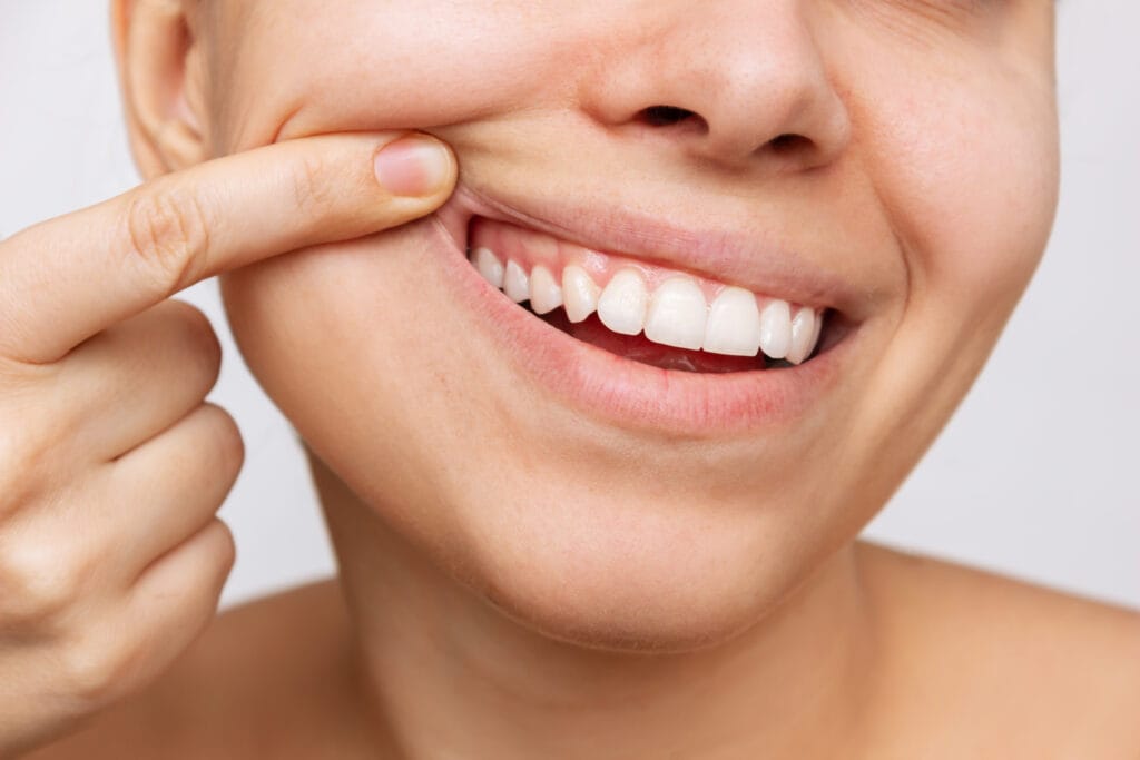 Recession_487994700.jpg Close-up of a person pulling back their cheek to show healthy teeth and gumline.